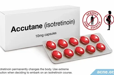 Accutane